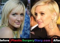 Ashlee Simpson Plastic Surgery Before and After