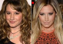Ashley Tisdale Nose Job before and after