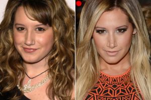 Ashley Tisdale Nose Job before and after