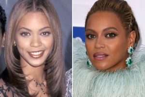 Beyonce Plastic Surgery