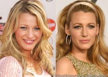 Blake Lively Nose Job