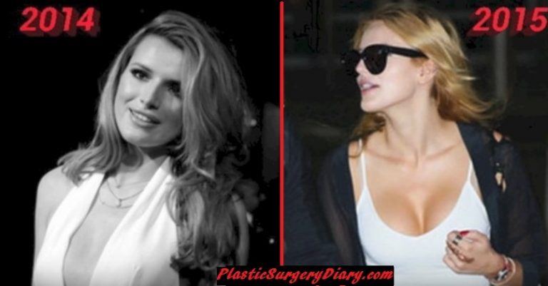 Bella Thorne boob job before and after comparison