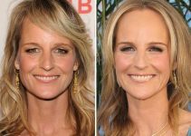 Helen Hunt Plastic Surgery