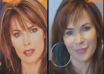 Lauren Koslow Plastic Surgery