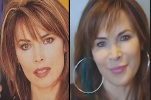 Lauren Koslow Plastic Surgery