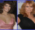 Raquel Welch Before & After Surgery