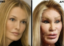 jocelyn wildenstein Before & After plastic surgery