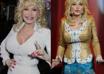 Dolly Parton Liposuction