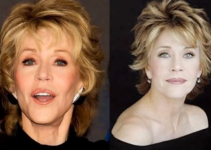 Jane Fonda Plastic Surgery 2