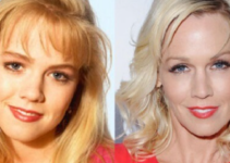 Did Jennie Garth had Plastic Surgery?