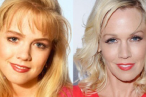 Did Jennie Garth had Plastic Surgery?