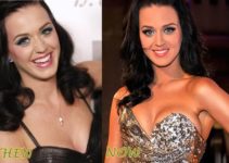 Katy Perry Breast Implants Buzz: The Real Deal or Not?