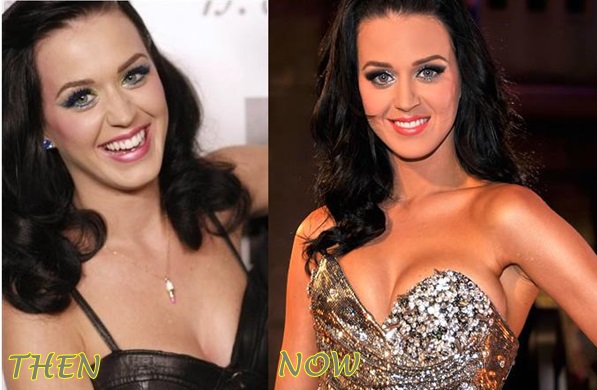 katy perry before and after implants