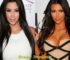 Kim Kardashian Plastic Surgery Before and After 2026: The Shocking Truth Behind Her Iconic Look!