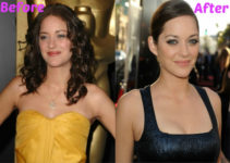 Did Marion Cotillard Have Breast Implants?