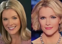 Megyn Kelly Plastic Surgery, Breast Implants Before and After