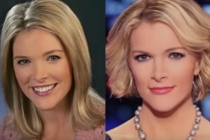 Megyn Kelly Plastic Surgery, Breast Implants Before and After
