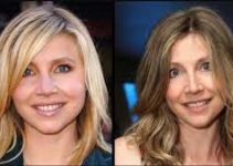 Sarah Chalke Plastic Surgery, Nose Job And Botox