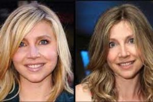 Sarah Chalke Plastic Surgery, Nose Job And Botox