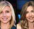 Sarah Chalke Plastic Surgery Before and After: Nose Job, Botox, Fillers & What We Really Know