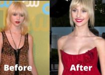 Taylor Momsen Breast Implants and Nose Job