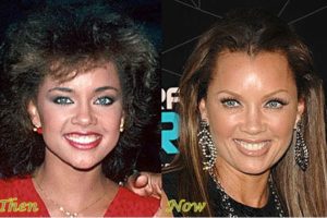 Vanessa Williams Plastic Surgery: The Ageless Beauty Secret