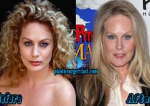 Beverly D’Angelo Plastic Surgery Before And After Photos