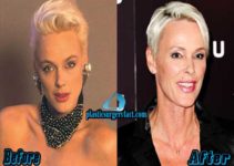 Brigitte Nielsen Plastic Surgery Before And After Photos