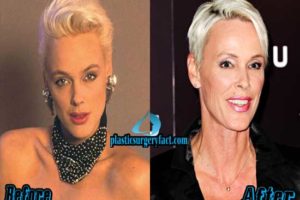 Brigitte Nielsen Plastic Surgery Before And After Photos