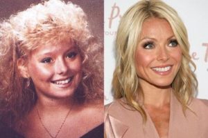 Kelly Ripa Plastic Surgery Before and After: Her Honest Botox & Mini-Facelift Journey in 2026 at 55!