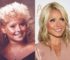 Kelly Ripa Plastic Surgery Before and After: Her Honest Botox & Mini-Facelift Journey in 2026 at 55!