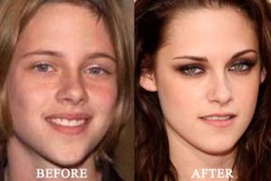 Kristen Stewart Plastic Surgery Before and After: Nose Job Rumors & Her Natural Glow at 35 in 2026!
