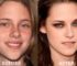 Kristen Stewart Plastic Surgery Before and After: Nose Job Rumors & Her Natural Glow at 35 in 2026!