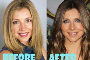 Sarah Chalke Plastic Surgery, Nose Job And Botox