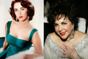 Did Elizabeth Taylor Had Plastic Surgery?