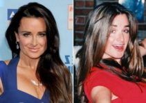 Carole Radziwill Plastic Surgery – from Facelift to Rhinoplasty