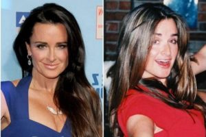 Carole Radziwill Plastic Surgery – from Facelift to Rhinoplasty