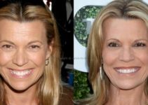 Vanna White Seems Has Done Plastic Surgery