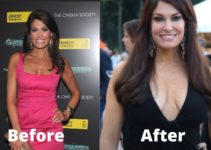 Kimberly Guilfoyle Breast Size