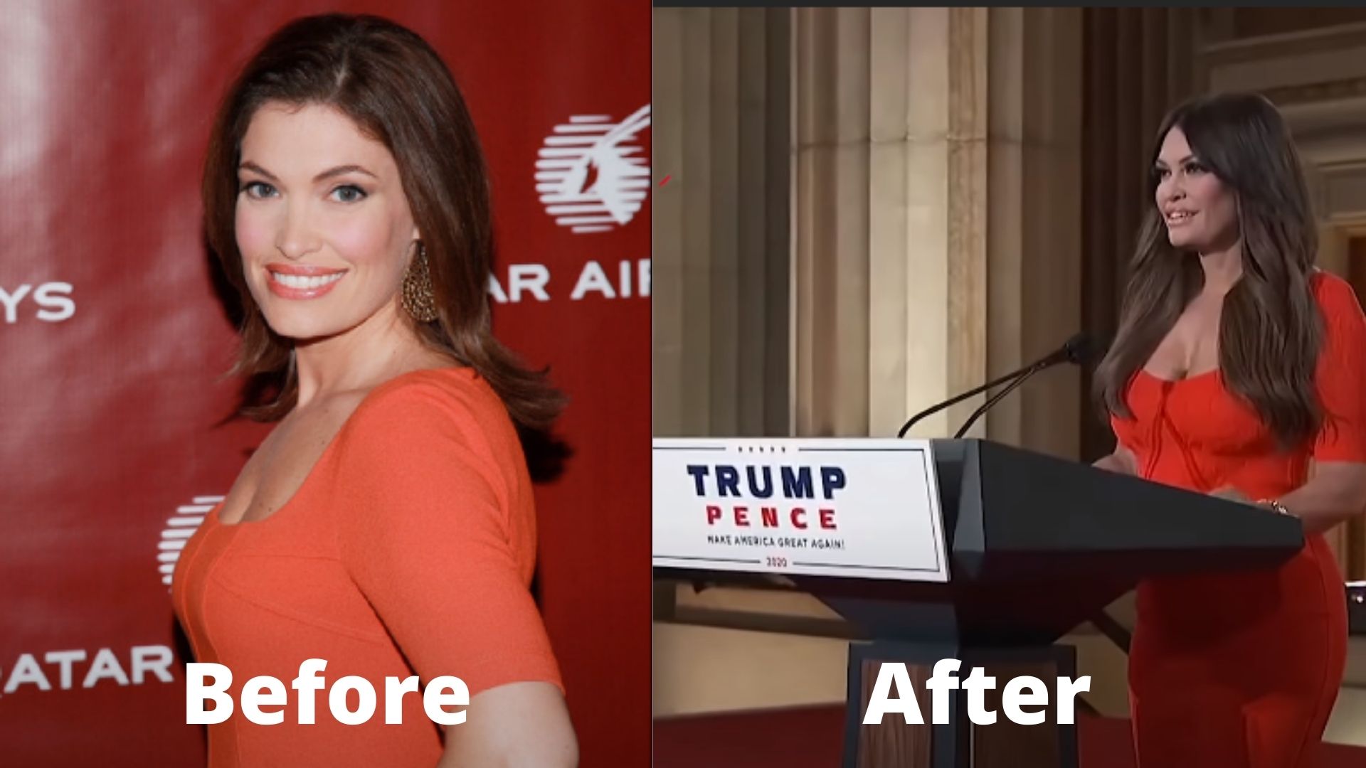 Kimberly guilfoyle breasts