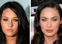 Megan Fox Is Susceptible for Having Plastic Surgery