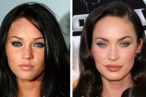Megan Fox Is Susceptible for Having Plastic Surgery