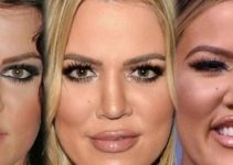 Khloe Kardashian Before Plastic Surgery