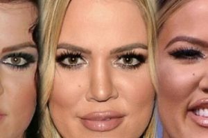 Khloe Kardashian Before Plastic Surgery