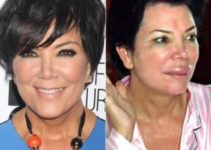 Kriss Jenner Before Plastic Surgery