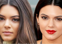 Kendall Jenner Nose Job