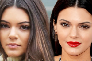 Kendall Jenner Nose Job