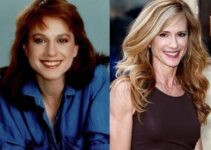 Holly Hunter Plastic Surgery Journey