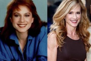 Holly Hunter Plastic Surgery Journey