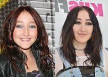 Noah Cyrus and Plastic Surgery: What's the Real Story?
